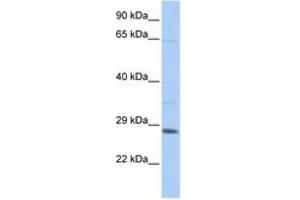 Image no. 1 for anti-TGFB-Induced Factor Homeobox 2-Like, X-Linked (TGIF2LX) (C-Term) antibody (ABIN6742653) (TGIF2LX Antikörper  (C-Term))