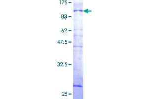 Image no. 1 for NEDD4 Binding Protein 2-Like 2 (N4BP2L2) (AA 1-583) protein (GST tag) (ABIN1311889) (N4BP2L2 Protein (AA 1-583) (GST tag))