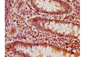 Immunohistochemistry (IHC) image for anti-Nuclear Factor of Activated T-Cells, Cytoplasmic, Calcineurin-Dependent 1 (NFATC1) (AA 48-406) antibody (ABIN7161789)