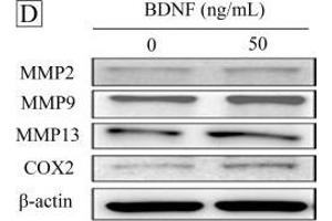 Western Blotting (WB) image for anti-Matrix Metallopeptidase 13 (Collagenase 3) (MMP13) antibody (ABIN2854829)