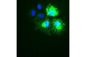 Image no. 1 for anti-Keratin 18 (KRT18) (AA 69-372) antibody (ABIN1491638) (Cytokeratin 18 Antikörper  (AA 69-372))