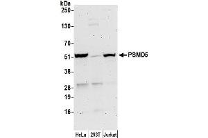 anti-Proteasome (Prosome, Macropain) 26S Subunit, Non-ATPase, 5 (PSMD5) (AA 325-375) antibody