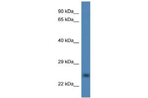 WB Suggested Anti-CCS Antibody Titration: 1.