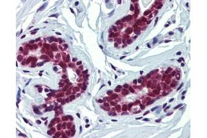 FUBP3 antibody was used for immunohistochemistry at a concentration of 4-8 ug/ml. (FUBP3 Antikörper  (Middle Region))