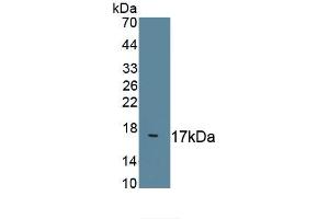 Detection of Recombinant F8, Mouse using Polyclonal Antibody to Coagulation Factor VIII (F8)