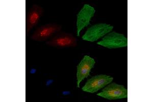 ABIN6266034 and ABIN6277649 staining  cells by IF/ICC. (WNK3 Antikörper  (C-Term))