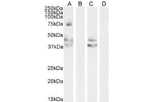 Western Blotting (WB) image for anti-Angiotensin II Receptor, Type 1 (AGTR1) (Internal Region) antibody (ABIN190902)