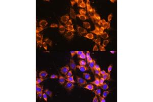 Immunofluorescence analysis of NIH-3T3 cells using  antibody  at dilution of 1:100. (ACAT1 Antikörper)