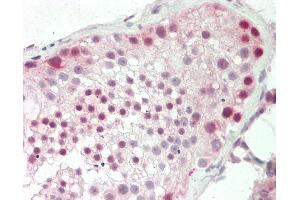 Human Testis: Formalin-Fixed, Paraffin-Embedded (FFPE) (PRMT10 Antikörper  (AA 1-50))