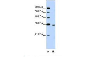 Image no. 1 for anti-2,4-Dienoyl CoA Reductase 2, Peroxisomal (DECR2) (N-Term) antibody (ABIN320805) (DECR2 Antikörper  (N-Term))