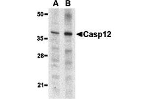 Western Blotting (WB) image for anti-Caspase 12 (Gene/pseudogene) (CASP12) (Small Isoform) antibody (ABIN1031700)