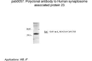 Image no. 2 for anti-Synaptosomal-Associated Protein, 23kDa (SNAP23) antibody (ABIN347010) (SNAP23 Antikörper)