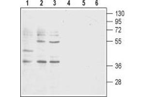 Western blot analysis of acute T-cell leukemia Jurkat (lanes 1 and 4), promyelocytic leukemia HL-60 (lanes 2 and 5) and acute monocytic leukemia THP-1 (lanes 3 and 6) human cell lysates: - 1-3. (Leukotriene B4 Receptor/BLT Antikörper  (2nd Extracellular Loop))