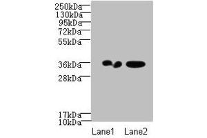 Western blot All lanes: RPRD1A antibody at 2 μg/mL Lane 1: A431 whole cell lysate Lane 2: Jurkat whole cell lysate Secondary Goat polyclonal to Rabbit IgG at 1/10000 dilution Predicted band size: 36, 32 kDa Observed band size: 36 kDa (RPRD1A Antikörper  (AA 2-276))