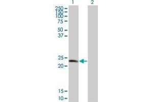 Western Blot analysis of TPD52 expression in transfected 293T cell line by TPD52 monoclonal antibody (M01), clone 1B6. (TPD52 Antikörper  (AA 100-184))