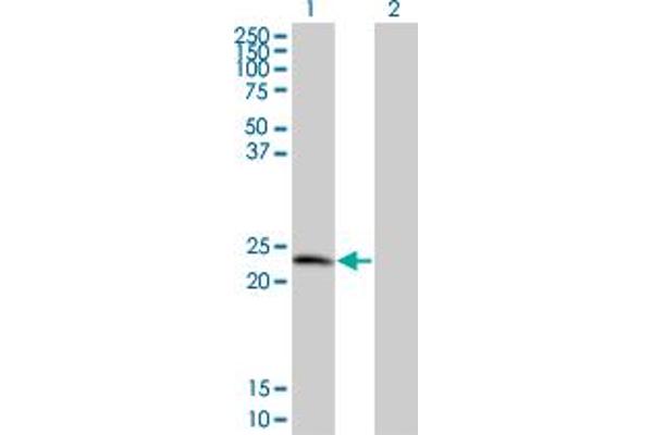 TPD52 antibody  (AA 100-184)