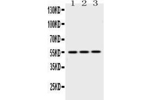 Western blot analysis of Caspase8 using anti-Caspase8 antibody . (Caspase 8 Antikörper  (N-Term))