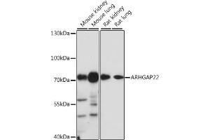 Western blot analysis of extracts of various cell lines, using  antibody (ABIN7269964) at 1:1000 dilution. (ARHGAP22 Antikörper  (AA 510-650))