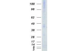 Western Blotting (WB) image for serine/threonine Kinase 17b (STK17B) protein (Myc-DYKDDDDK Tag) (ABIN2732863)