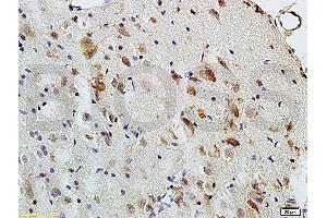 Formalin-fixed and paraffin embedded: rat brain tissue labeled with Anti-MBP Polyclonal Antibody (ABIN739400), Unconjugated at 1:200, followed by conjugation to the secondary antibody and DAB staining (MBP Antikörper  (AA 69-85))