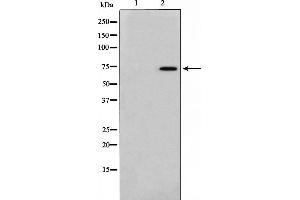 Western blot analysis of FKHR phosphorylation expression in HeLa whole cell lysates,The lane on the left is treated with the antigen-specific peptide.