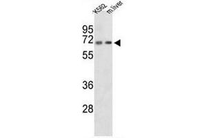 Western blot analysis of CROT Antibody (N-term) in K562 cell line and mouse liver tissue lysates (35µg/lane). (CROT Antikörper  (N-Term))