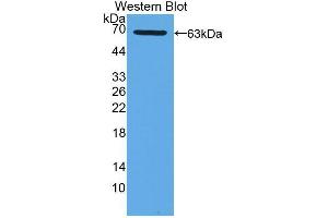Western blot analysis of the recombinant protein. (XDH Antikörper  (AA 1-300))