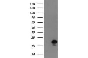 HEK293T cells were transfected with the pCMV6-ENTRY control (Left lane) or pCMV6-ENTRY DSTN (Right lane) cDNA for 48 hrs and lysed. (Destrin Antikörper)
