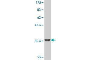 Western Blot detection against Immunogen (36. (SHANK2 Antikörper  (AA 1034-1124))