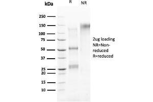 SDS-PAGE Analysis Purified HER-4 / ERBB4 Mouse Monoclonal Antibody (ERBB4/2581). (ERBB4 Antikörper  (AA 1116-1269))