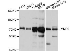 Western blot analysis of extracts of various cell lines, using MMP2 antibody (ABIN5998246) at 1/1000 dilution. (MMP2 Antikörper)