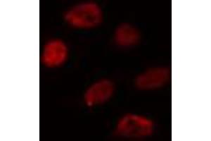 ABIN6274359 staining HuvEc cells by IF/ICC. (WTAP Antikörper  (C-Term))