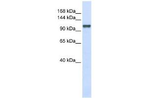 CHERP antibody used at 1 ug/ml to detect target protein.