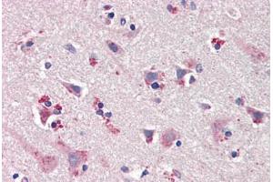 Human Brain, Cortex (formalin-fixed, paraffin-embedded) stained with NOS1 antibody ABIN461965 at 20 ug/ml followed by biotinylated goat anti-rabbit IgG secondary antibody ABIN481713, alkaline phosphatase-streptavidin and chromogen.