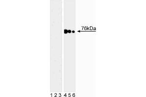Western blot analysis of SLP-76 (pY128) in human T leukemia. (LCP2 Antikörper  (pTyr128))