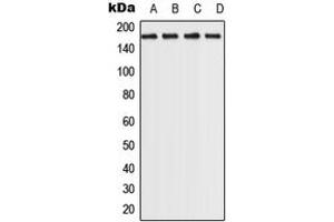 Western blot analysis of ROCK2 expression in MCf7 (A), HeLa (B), NIH3T3 (C), PC12 (D) whole cell lysates. (ROCK2 Antikörper  (C-Term))