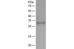 Western Blotting (WB) image for Jumonji Domain Containing 7 (JMJD7) (AA 1-316) protein (His tag) (ABIN7123648) (JMJD7 Protein (AA 1-316) (His tag))