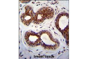 KIAA1586 Antibody immunohistochemistry analysis in formalin fixed and paraffin embedded human breast tissue followed by peroxidase conjugation of the secondary antibody and DAB staining. (KIAA1586 Antikörper  (N-Term))