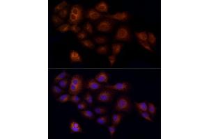 anti-RAB5C, Member RAS Oncogene Family (Rab5c) antibody