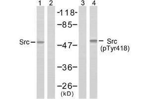 Western blot analysis of extracts from COLO205 cells using Src (Ab-418) antibody (E021115, Lane 1 and 2) and Src (phospho-Tyr418) antibody (E011091, Lane 3 and 4). (Src Antikörper  (pTyr418))