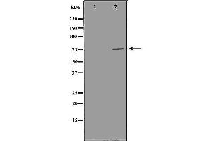Western Blotting (WB) image for anti-Forkhead Box P1 (FOXP1) (C-Term) antibody (ABIN6261807)