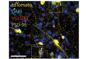 40x confocal images of mixed excitatory/inhibitory iN co-culture on astrocytes containing a small fraction of tdTomato-expressing iN cells. (tdTomato Antikörper)
