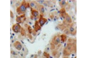 Used in DAB staining on fromalin fixed paraffin-embedded Liver tissue (Hepcidin Antikörper  (AA 24-83))