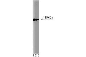 Western blot analysis of Sec8 on a MDCK cell lysate (Canine kidney, ATCC CCL-34). (Sec8 Antikörper  (AA 31-201))