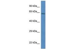 Image no. 1 for anti-P21-Activated Kinase 4 (PAK4) (AA 23-72) antibody (ABIN6746289) (PAK4 Antikörper  (AA 23-72))