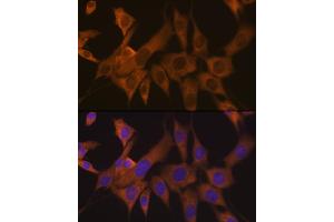 Immunofluorescence analysis of NIH-3T3 cells using eIF3B Rabbit mAb (ABIN7267042) at dilution of 1:100 (40x lens). (EIF3B Antikörper)