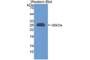Western Blotting (WB) image for anti-B-Cell CLL/lymphoma 9 (BCL9) (AA 1118-1327) antibody (ABIN1866886) (BCL9 Antikörper  (AA 1118-1327))