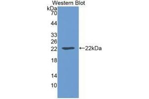 Detection of Recombinant LEP, Mouse using Monoclonal Antibody to Leptin (LEP) (Leptin Antikörper  (AA 22-167))