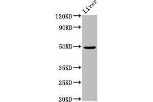 Western Blot Positive WB detected in: Mouse liver tissue All lanes: PPM1F antibody at 3 μg/mL Secondary Goat polyclonal to rabbit IgG at 1/50000 dilution Predicted band size: 50, 39 kDa Observed band size: 50 kDa
