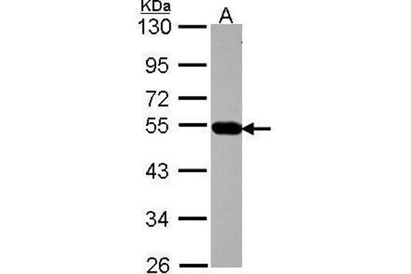 AP4M1 Antikörper  (Center)